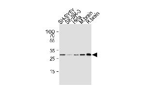 Western blot analysis of lysates from SH-SY5Y, SK-BR-3, Hela cell line, mouse brain and rat brain tissue lysate(from left to right), using CDK5 Antibody (ABIN1945087 and ABIN2843647). (CDK5 anticorps)