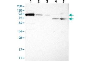 Western blot analysis of Lane 1: RT-4, Lane 2: U-251 MG, Lane 3: Human Plasma, Lane 4: Liver, Lane 5: Tonsil with FAM129B polyclonal antibody . (MEG3 anticorps)