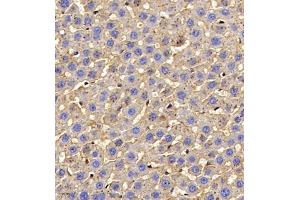 Immunohistochemistry of paraffin embedded rat liver using AHSG (ABIN7073021) at dilution of 1:700 (400x lens) (Fetuin A anticorps)