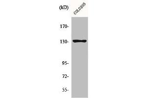 Western Blot analysis of COLO205 cells using JMY Polyclonal Antibody