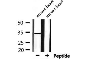 Western blot analysis of extracts from mouse heart, using HP1gamma Antibody. (CBX3 anticorps  (Internal Region))