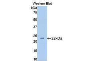 Western Blotting (WB) image for anti-Slit Homolog 1 (SLIT1) (AA 611-791) antibody (ABIN1860575)
