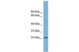 WB Suggested Anti-PERP  Antibody Titration: 0. (PERP anticorps  (Middle Region))
