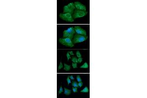 ICC/IF analysis of TXNRD1 in Hep3B cells line, stained with DAPI (Blue) for nucleus staining and monoclonal anti-human TXNRD1 antibody (1:100) with goat anti-mouse IgG-Alexa fluor 488 conjugate (Green). (TXNRD1 anticorps)