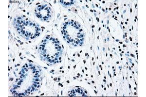 Immunohistochemical staining of paraffin-embedded breast tissue using anti-BRAF mouse monoclonal antibody. (BRAF anticorps)