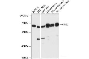 Western blot analysis of extracts of various cell lines using VSIG1 Polyclonal Antibody at dilution of 1:3000. (VSIG1 anticorps)