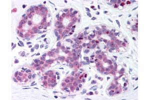 Anti-Estrogen Receptor antibody IHC of human breast. (ITIH1 anticorps  (AA 410-592))
