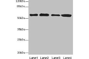 Western blot All lanes: TXNRD1 antibody at 5 μg/mL Lane 1: Jurkat whole cell lysate Lane 2: A549 whole cell lysate Lane 3: MCF-7 whole cell lysate Lane 4: Hela whole cell lysate Secondary Goat polyclonal to rabbit IgG at 1/10000 dilution Predicted band size: 71, 60, 66, 61, 55, 68, 51 kDa Observed band size: 60 kDa (TXNRD1 anticorps  (AA 1-497))