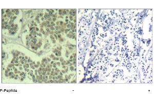 Image no. 1 for anti-Eukaryotic Translation Initiation Factor 2 Subunit 1 (EIF2S1) (pSer49) antibody (ABIN319275) (EIF2S1 anticorps  (pSer49))