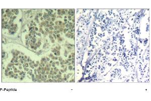 Image no. 1 for anti-Eukaryotic Translation Initiation Factor 2 Subunit 1 (EIF2S1) (pSer49) antibody (ABIN319276) (EIF2S1 anticorps  (pSer49))