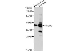 Western blot analysis of extracts of various cell lines, using ASGR2 Antibody (ABIN6290077) at 1:1000 dilution. (Asialoglycoprotein Receptor 2 anticorps)