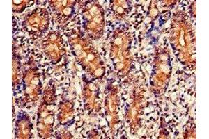 Immunohistochemistry of paraffin-embedded human small intestine tissue using ABIN7142858 at dilution of 1:100 (NUDT1 anticorps  (AA 49-82))