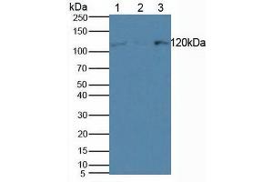 Figure. (HLTF anticorps  (AA 837-996))