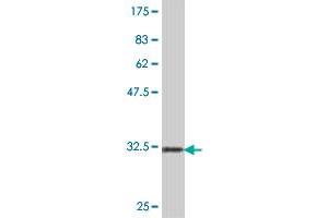 Western Blot detection against Immunogen (32.