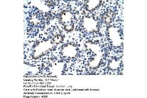 Rabbit Anti-CARS Antibody  Paraffin Embedded Tissue: Human Lung Cellular Data: Alveolar cells Antibody Concentration: 4.