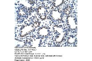 Rabbit Anti-CARS Antibody  Paraffin Embedded Tissue: Human Lung Cellular Data: Alveolar cells Antibody Concentration: 4. (CARS anticorps  (N-Term))