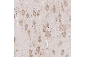 Immunohistochemical staining of human hippocampus with PREX1 polyclonal antibody  shows moderate cytoplasmic positivity in neuronal cells. (PREX1 anticorps)
