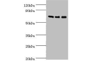 Western blot All lanes: AKAP10 antibody at 7 μg/mL Lane 1: 293T whole cell lysate Lane 2: Hela whole cell lysate Lane 3: HepG2 whole cell lysate Secondary Goat polyclonal to rabbit IgG at 1/10000 dilution Predicted band size: 74 kDa Observed band size: 74 kDa (AKAP1 anticorps  (AA 413-662))