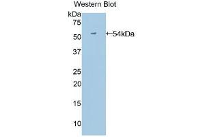 Western blot analysis of the recombinant protein. (ANGPTL3 anticorps  (AA 17-460))