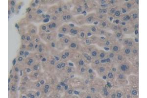 Detection of AIMP1 in Mouse Liver Tissue using Polyclonal Antibody to Aminoacyl tRNA Synthetase Complex Interacting Multifunctional Protein 1 (AIMP1)