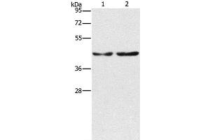 Western Blot analysis of Hela and 293T cell using CBX6 Polyclonal Antibody at dilution of 1:600 (CBX6 anticorps)