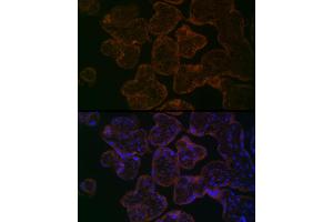 Immunofluorescence analysis of Human placenta using MYO5B antibody (ABIN6129305, ABIN6144287, ABIN6144288 and ABIN6224655) at dilution of 1:100. (MYO5B anticorps  (AA 1440-1690))