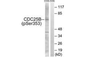 Western blot analysis of extracts from COS7 cells treated with etoposide 25uM 24h, using CDC25B (Phospho-Ser353) Antibody.