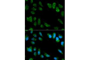 Immunofluorescence analysis of MCF-7 cells using IL1RN antibody. (IL1RN anticorps)