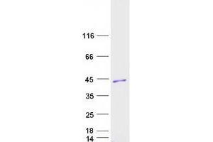Validation with Western Blot