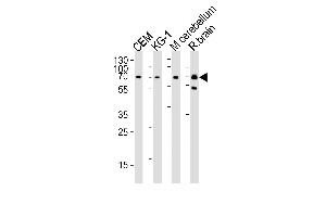 Western blot analysis of lysates from CEM, KG-1 cell line, mouse cerebellum and rat brain tissue lysate (from left to right), using MTF2 Antibody (Center) (ABIN1538252 and ABIN2849778).