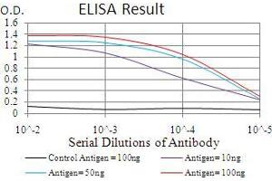 Black line: Control Antigen (100 ng), Purple line: Antigen(10 ng), Blue line: Antigen (50 ng), Red line: Antigen (100 ng),