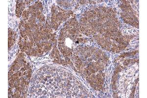 IHC-P Image Cyclin B1 antibody detects Cyclin B1 protein at cytoplasm on mouse ovary by immunohistochemical analysis. (Cyclin B1 anticorps)