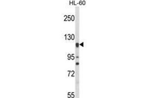 Western blot analysis of NOS3 Antibody (N-term) in HL-60 cell line lysates (35ug/lane). (ENOS anticorps  (N-Term))