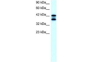 ACAT2 antibody used at 2 ug/ml to detect target protein. (ACAT2 anticorps)