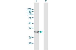 Western Blot analysis of ADAMTS4 expression in transfected 293T cell line by ADAMTS4 MaxPab polyclonal antibody.