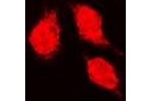 Immunofluorescent analysis of Glutathione Synthetase staining in K562 cells. (Glutathione Synthetase anticorps)
