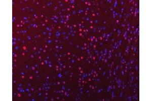 IF analysis of hnRNP U/p120/HNRNPU using anti-hnRNP U/p120/HNRNPU antibody (ABIN7600979).