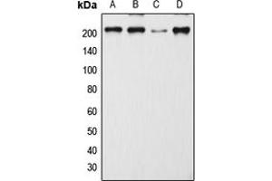 Western blot analysis of CD205 expression in MCF7 (A), SP2/0 (B), H9C2 (C), mouse lymph node (D) whole cell lysates. (LY75/DEC-205 anticorps  (Center))