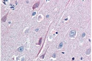 Human Brain, Cortex (formalin-fixed, paraffin-embedded) stained with TrkB antibody ABIN337266 at 10 ug/ml followed by biotinylated goat anti-rabbit IgG secondary antibody ABIN481713, alkaline phosphatase-streptavidin and chromogen. (TRKB anticorps  (AA 1-429))