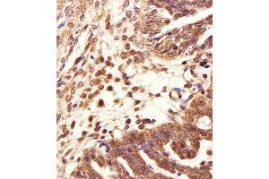Immunohistochemical analysis of paraffin-embedded H.