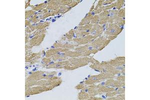 Immunohistochemistry of paraffin-embedded mouse heart using CAST antibody (ABIN5970004) at dilution of 1/100 (40x lens). (Calpastatin anticorps)
