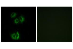 Immunofluorescence analysis of A549 cells, using CELSR3 antibody.