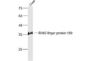 Mouse Liver lysates probed with RING finger protein 189 Polyclonal Antibody, Unconjugated  at 1:300 dilution and 4˚C overnight incubation. (RFFL anticorps  (AA 251-363))