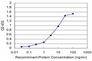 Detection limit for recombinant GST tagged CCT2 is approximately 0. (CCT2 anticorps  (AA 117-217))