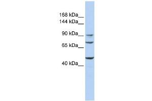 GALNT5 antibody used at 1 ug/ml to detect target protein. (GALNT5 anticorps)