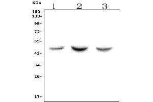 Western blot analysis of ASAH1 using anti-ASAH1 antibody (ABIN7602206). (ASAH1 anticorps  (AA 63-393))