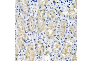 Immunohistochemistry of paraffin-embedded mouse kidney using SNAP29 antibody at dilution of 1:100 (x40 lens). (SNAP29 anticorps)