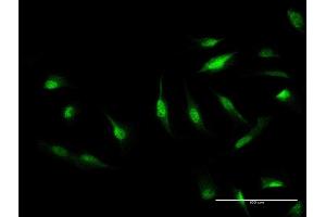 Immunofluorescence of monoclonal antibody to CAND1 on HeLa cell. (CAND1 anticorps  (AA 1-100))
