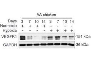 Hypoxia enhances angiogenesis-related protein expression.