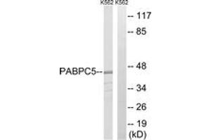 Western blot analysis of extracts from K562 cells, using PABPC5 Antibody. (PABPC5 anticorps  (AA 184-233))